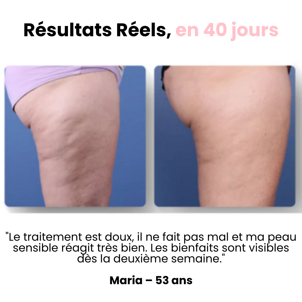 Masseur anti-cellulite Clarea